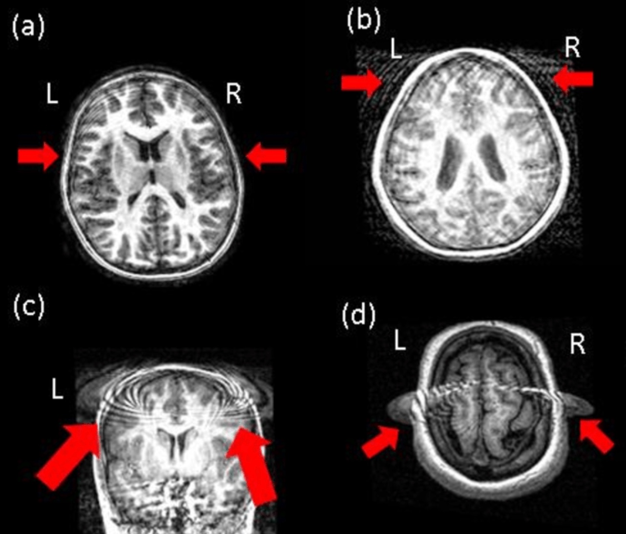 Network Analysis on fMRI Data